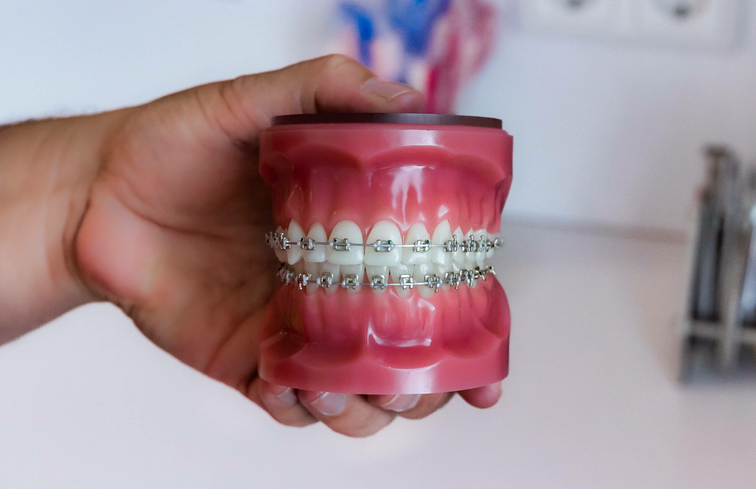 Selbstlegierende Brackets